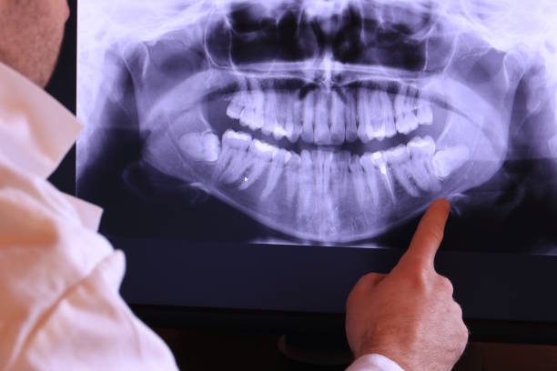 Best Broken or Cracked Tooth Emergency Dentist in Augusta, GA